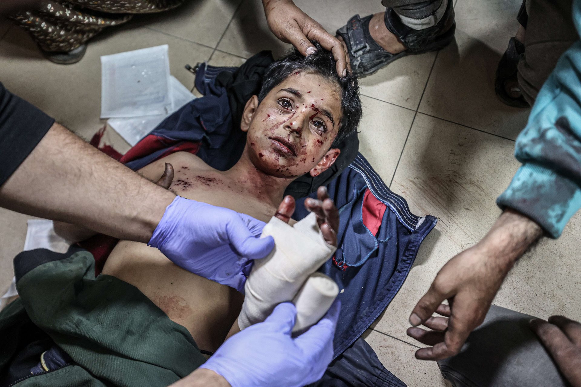 An injured boy is treated at al-Aqsa Hospital, Deir al-Balah, Gaza, after an Israeli attack on al-Maghazi IDP camp. The population of the camp tripled in the first months of the war. Israel frequently targeted IDP camps through the year, saying Hamas militants were embedding themselves there and using the residents as human shields. Israel targeted humanitarian zones more than 100 times between May 2024 and mid-January 2025.