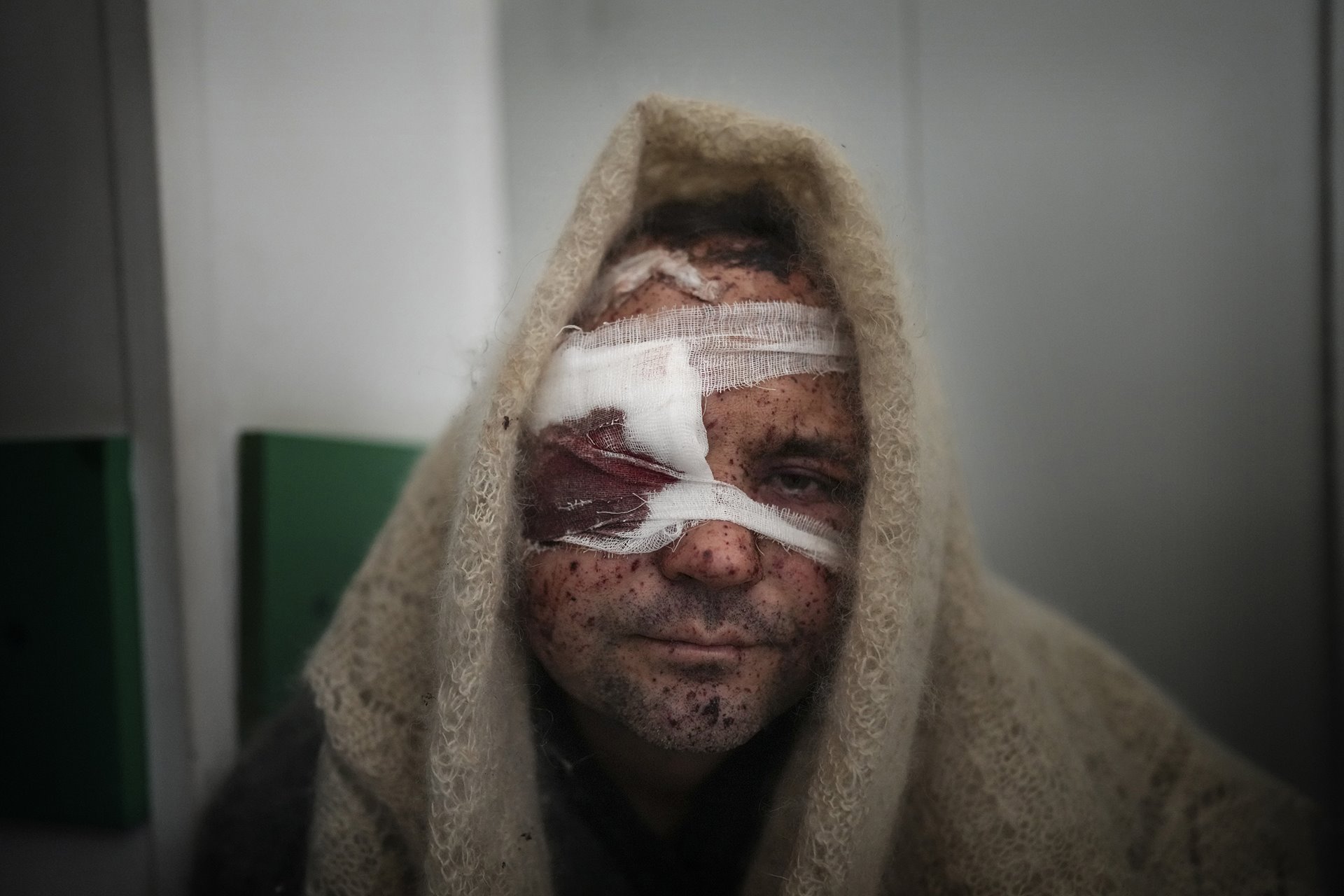 <p>Serhiy Kralya, a civilian injured during shelling by Russian forces, rests after surgery at a hospital in Mariupol, Ukraine.</p>
