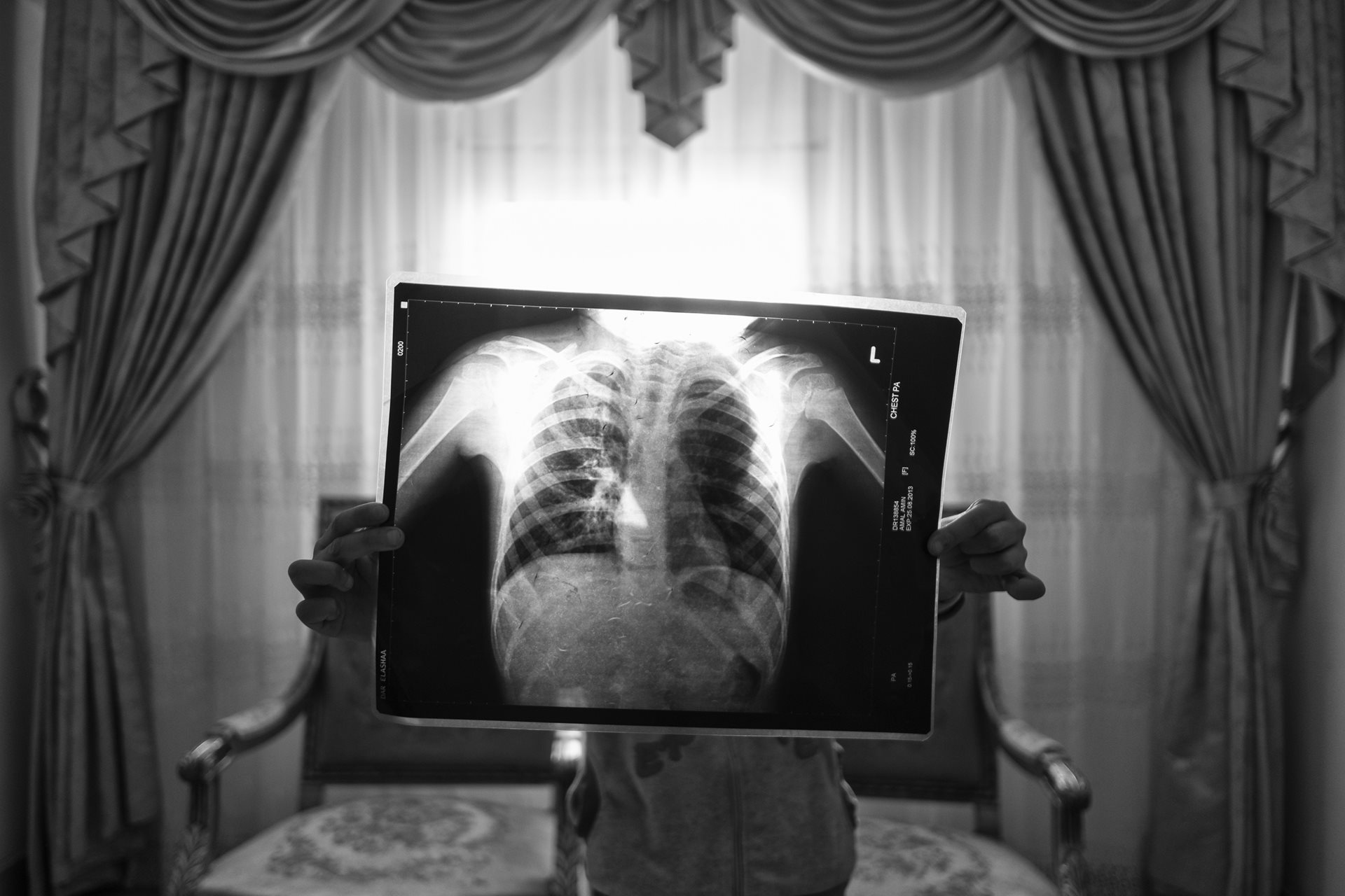 Amal (11) holds an X-ray of her lungs. She moved to Moon Valley in Alexandria, Egypt, at three years old and developed asthma within months.