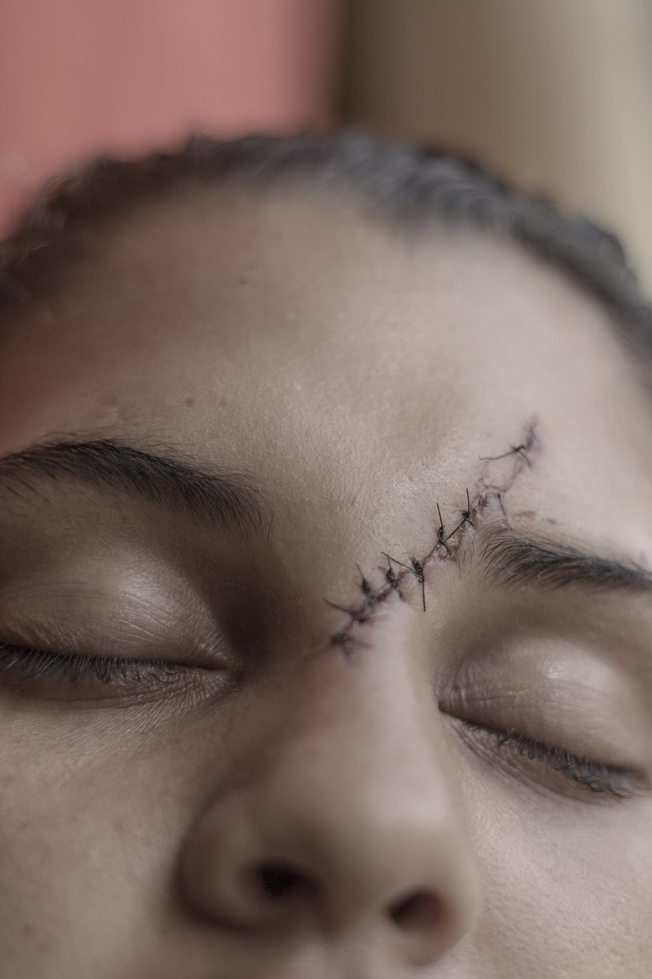 <p>A Venezuelan woman in the care of Colombian migration authorities bears the scar of an attack by a man who demanded sex as a payment for a tattoo, in Maicao, Colombia. Women migrants are often vulnerable to violence and human trafficking.</p>
