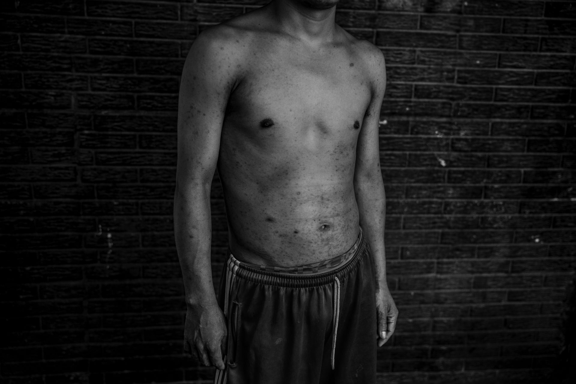 Samuel was arrested during the &ldquo;state of emergency.&rdquo; He was imprisoned for 13 months, where he endured beatings, humiliation, theft, and unsanitary conditions. He claims to have witnessed several cellmates commit suicide. Cuscatlán, El Salvador.