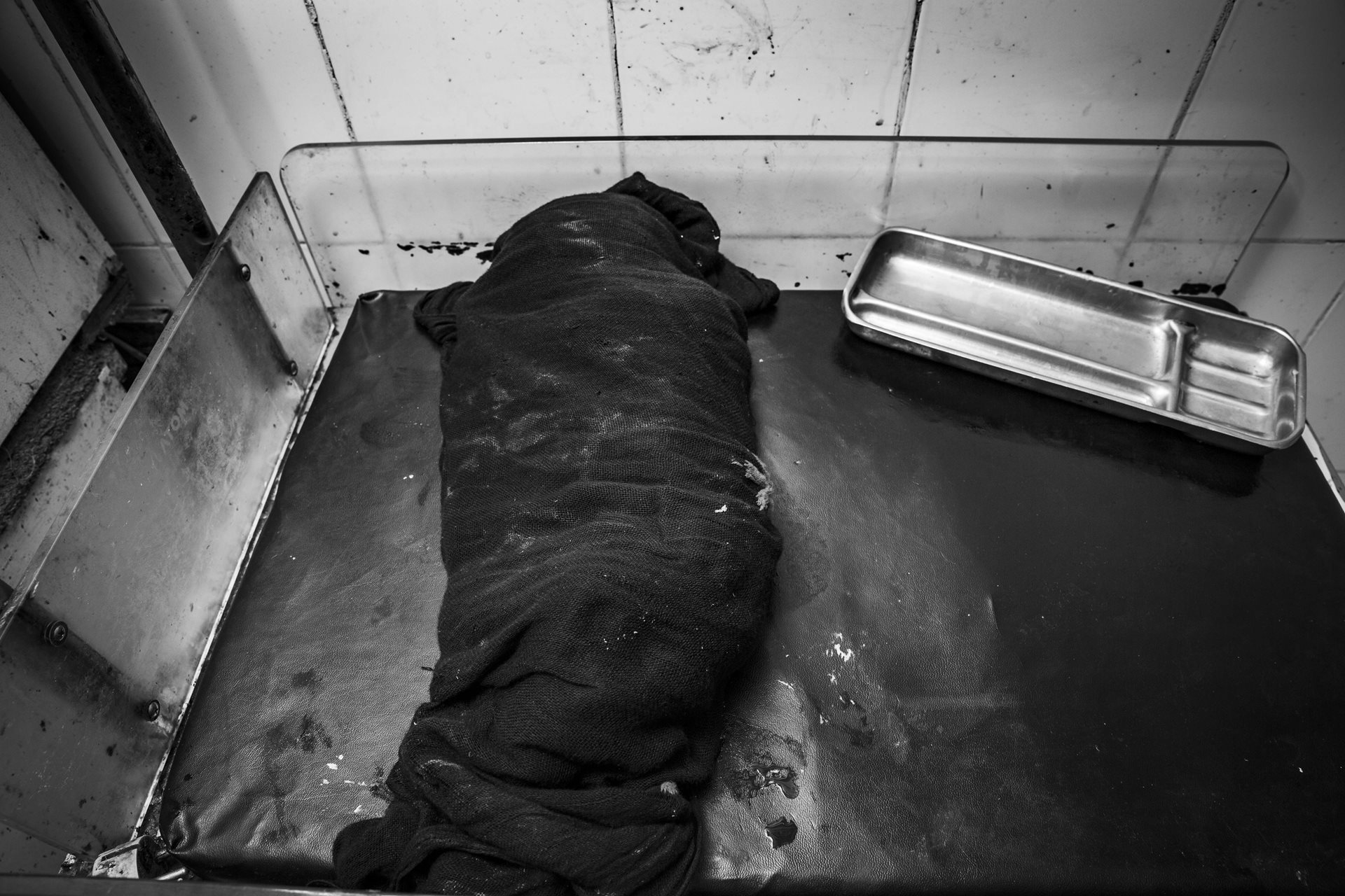 A stillborn baby whose refugee mother arrived at the clinic in critical condition in Kassala, Sudan. Fortunately, the mother survived. Many migrant and refugee women face economic, financial, and social difficulties that can interfere with prenatal care. This can result in adverse pregnancy outcomes, including stillbirths, which represent an unbearable trauma for mothers.