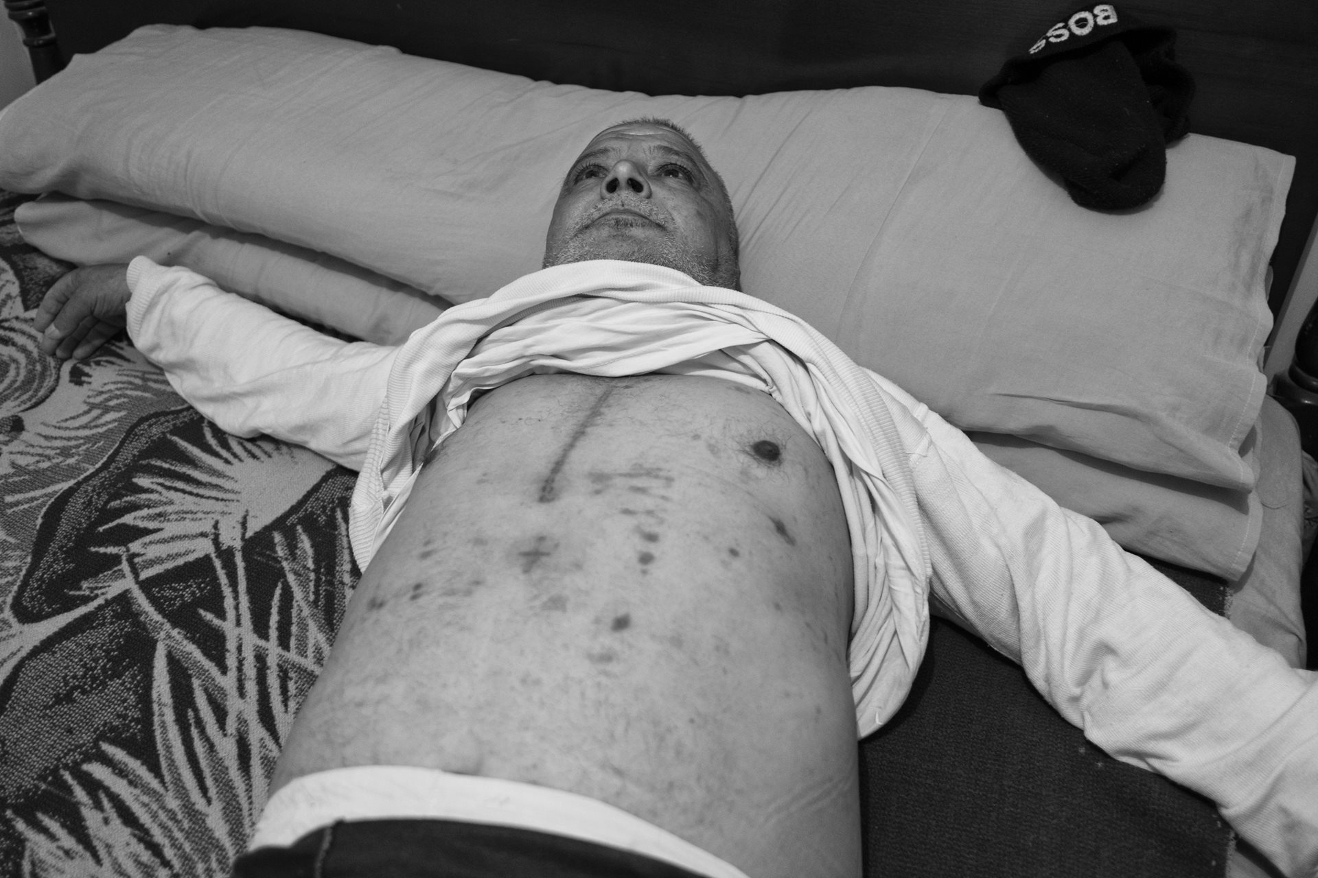 Ahmed Aniny filed a lawsuit but waited ten years without a ruling. After multiple surgeries, he insisted on this photograph: &ldquo;I want everyone to see what happened.&rdquo; He has since passed away. Moon Valley, Alexandria, Egypt.