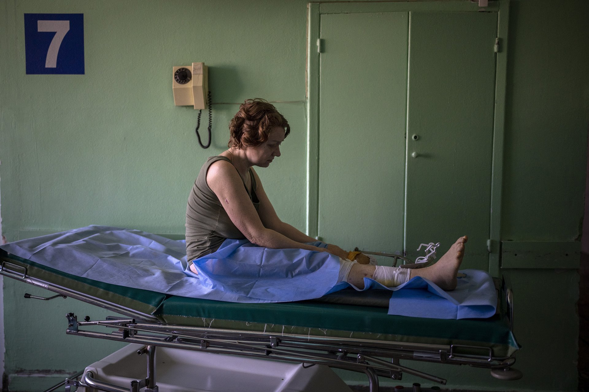 Olena Viter (45) waits outside an operating theater before surgery, at a public hospital in Kyiv, Ukraine. Olena lost her leg when her village, Rozvazhiv, in the Kyiv region, was bombed on 14 March. Her 14-year-old son Ivan was killed in the attack.