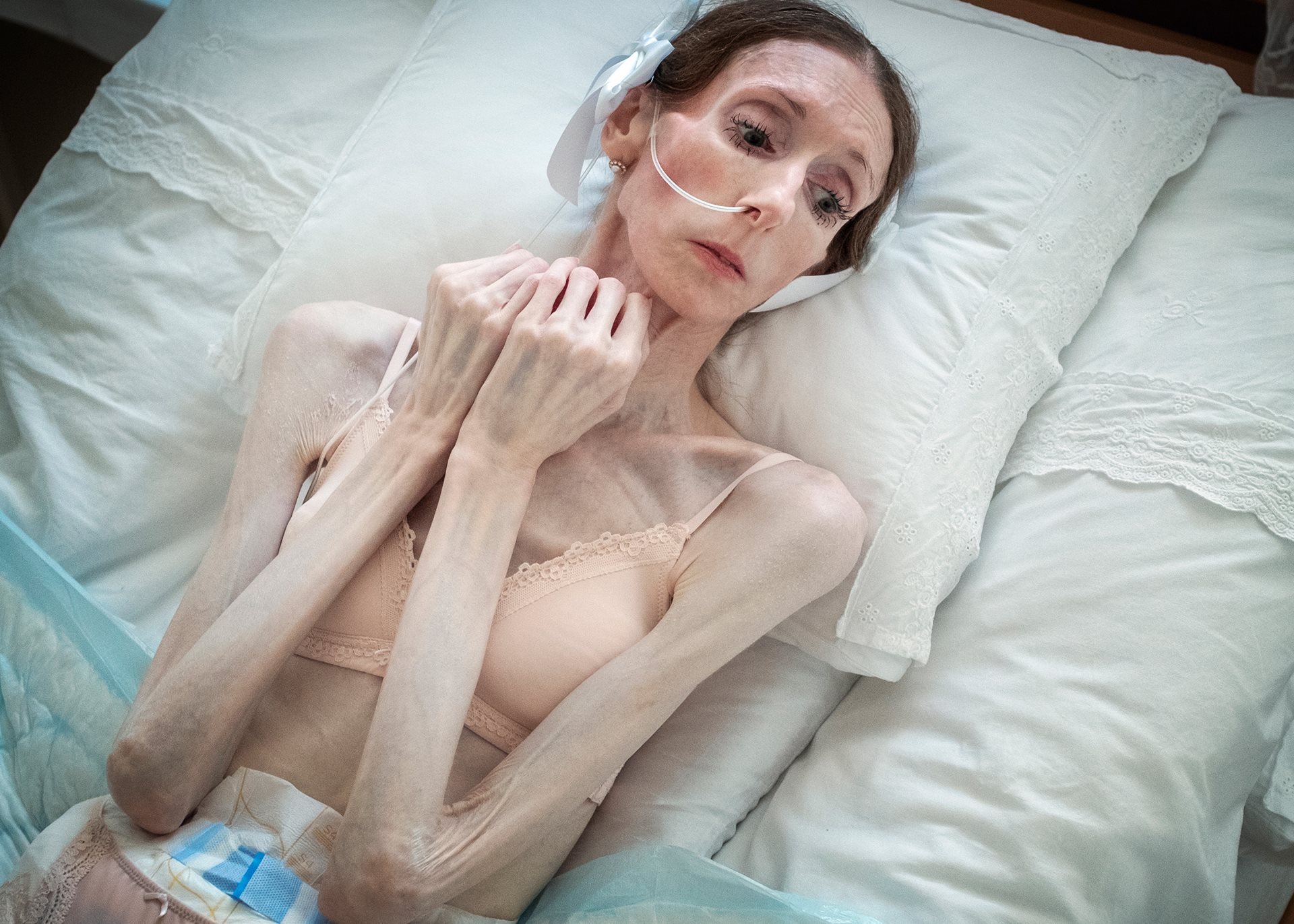 Engla Louise in her bed at home in Linköping, Sweden. At age ten, she sought psychiatric care accompanied by her mother, but was considered too young to receive treatment for anorexia.