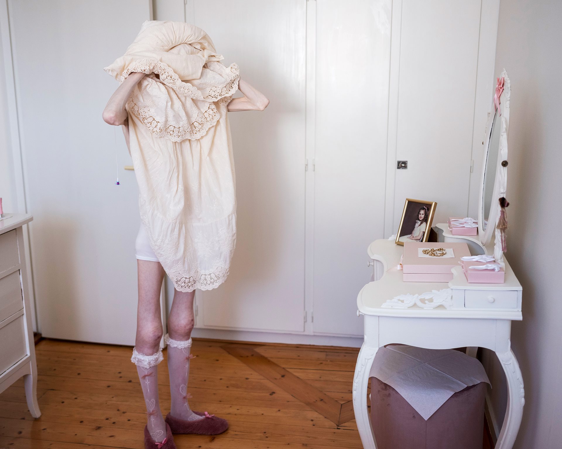 Swelling around Engla Louise&rsquo;s knees reveals severe edema, a sign of organ deterioration. On her dresser is a photograph of her as a young girl, taken before the illness took hold. Linköping, Sweden.