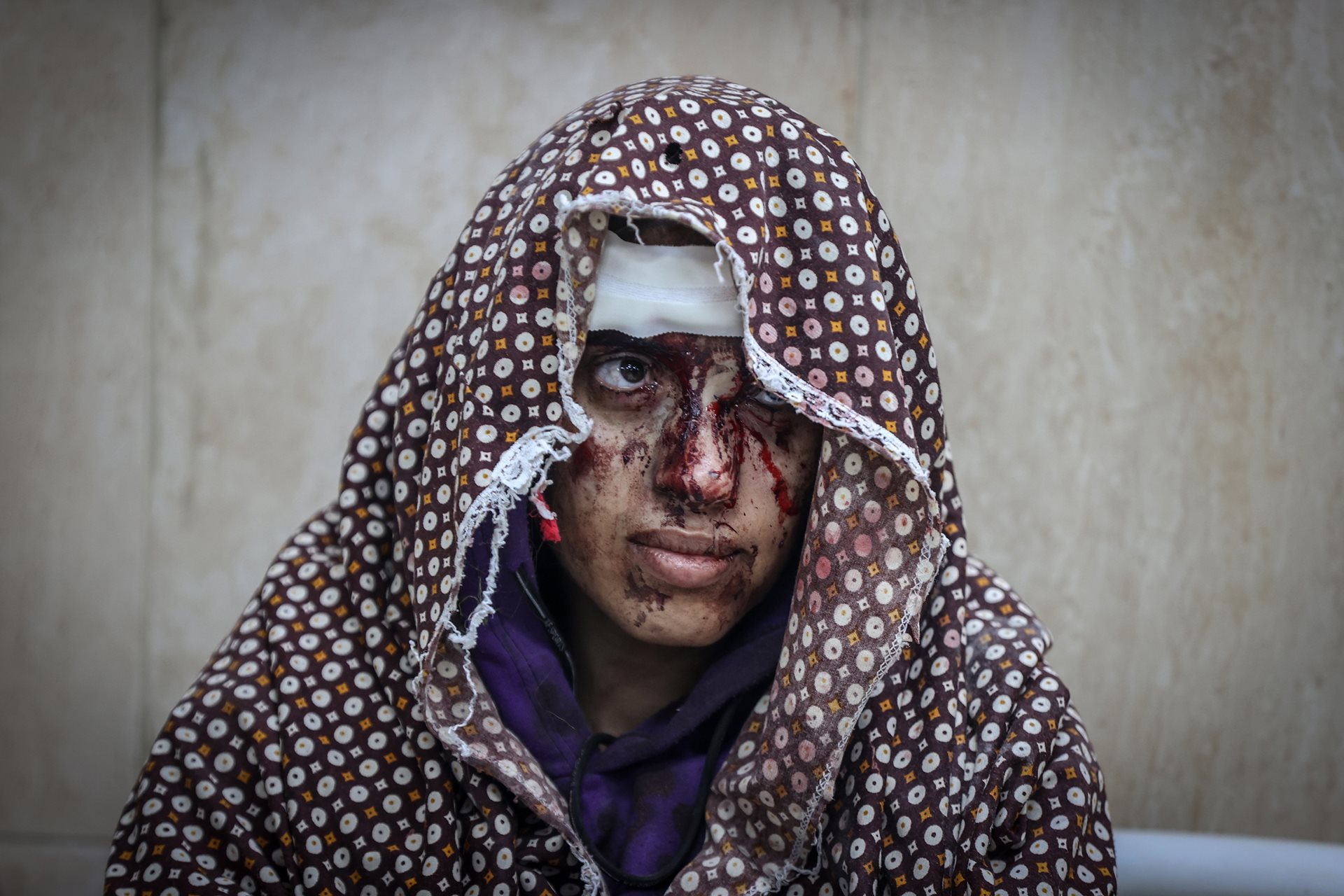 An injured woman is brought to al-Aqsa Hospital for medical treatment, after an Israeli attack on a house in Bureij IDP camp, near Deir al-Balah in Gaza. Israel frequently targeted IDP camps through the year, saying Hamas militants were embedding themselves there and using the residents as human shields. Israel targeted humanitarian zones more than 100 times between May 2024 and mid-January 2025.