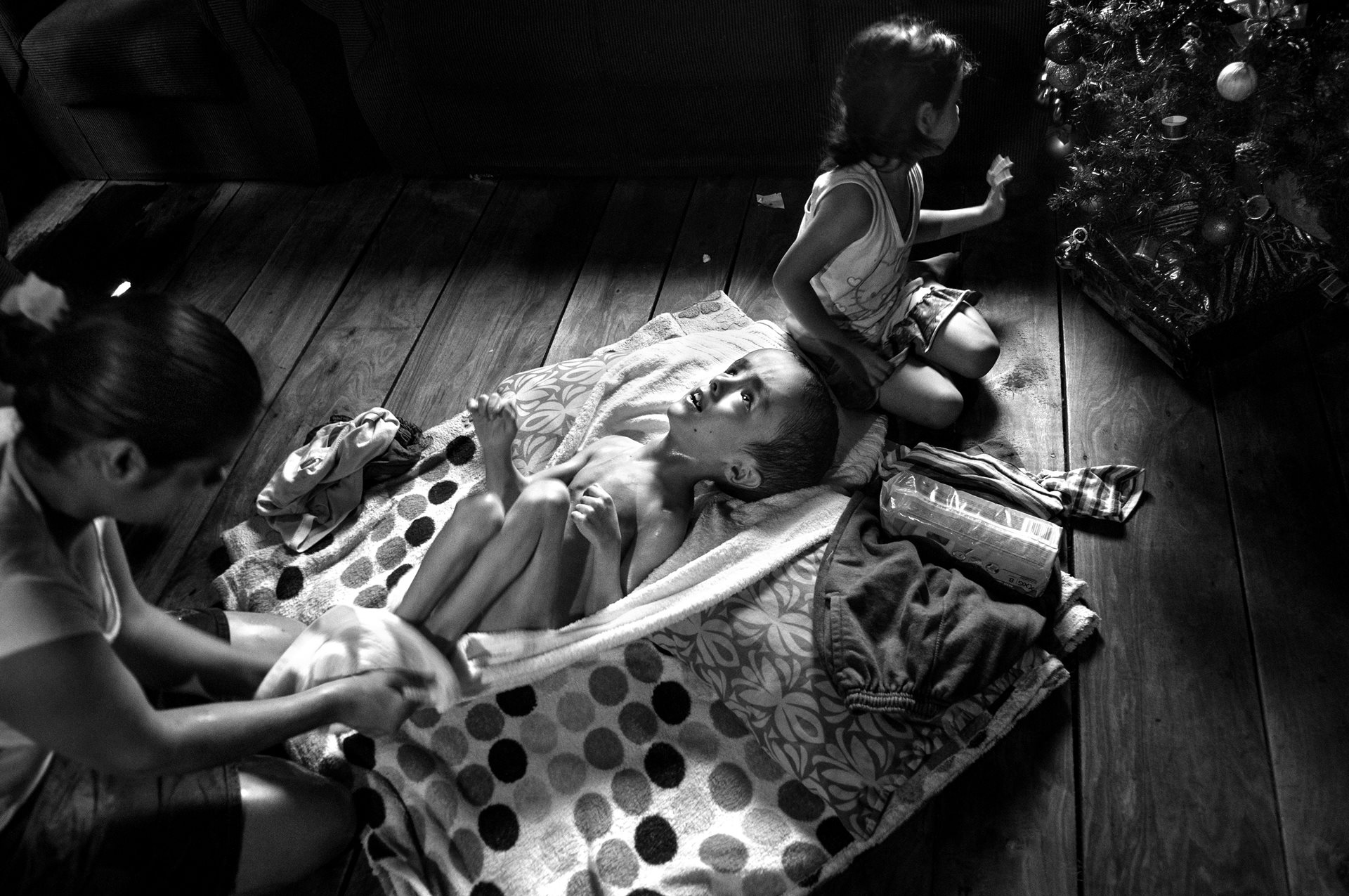 Cándida Rodríguez dries the feet of her son, Fabián Piris, who has hydrocephalus in Misiones, Argentina. Cándida handled agrochemicals on tobacco plantations during her pregnancy.
