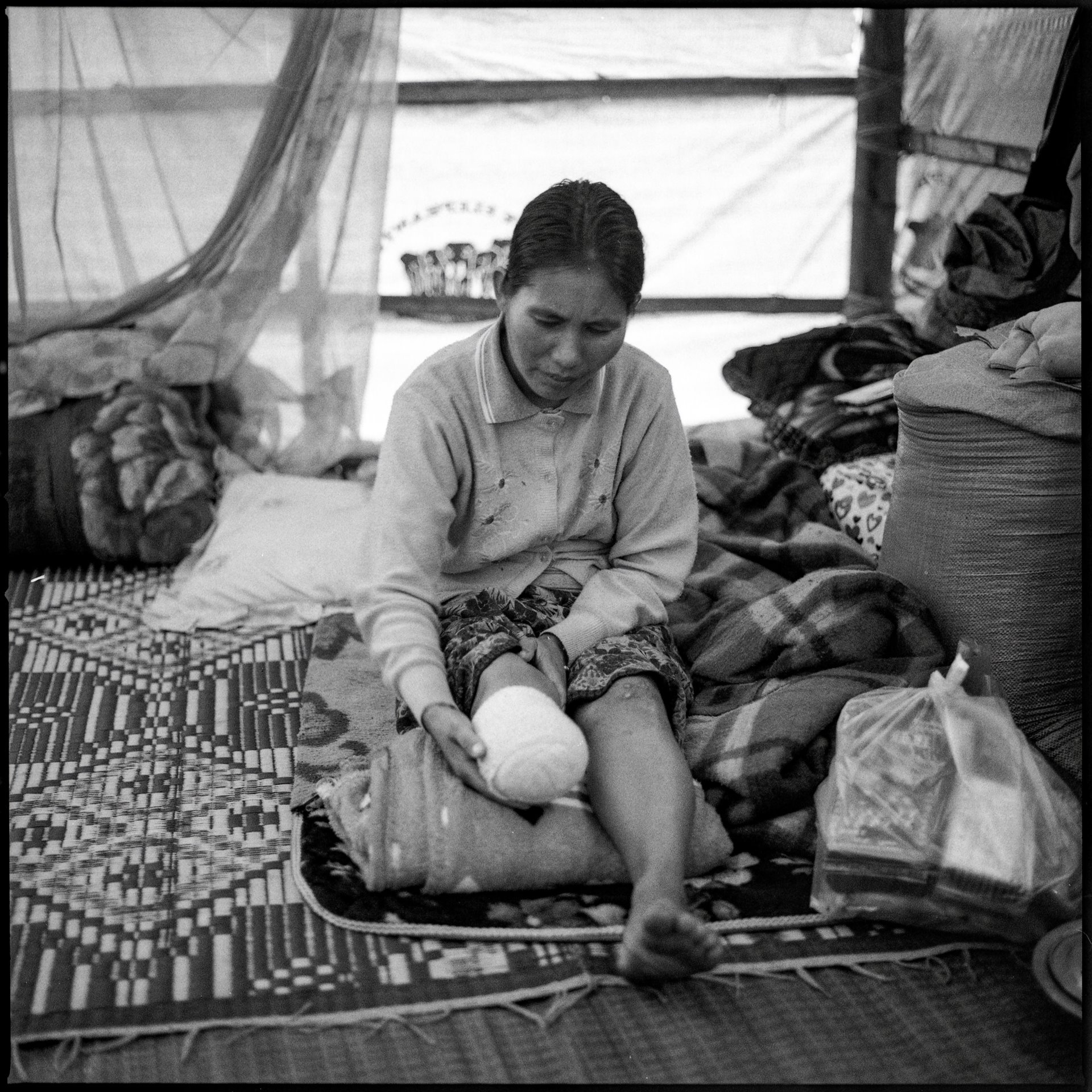 Daw Hla Win (34), a mother of three, stepped on a landmine as she returned to her village from collecting blankets at an IDP camp, in an area of intense fighting, in Shan State, Myanmar. Between February 2021 and September 2022, 157 civilians were killed and 395 injured by landmines and explosive remnants of war in Myanmar, according <em>The Landmine Monitor Report</em> 2022. About one-third of the casualties were children.