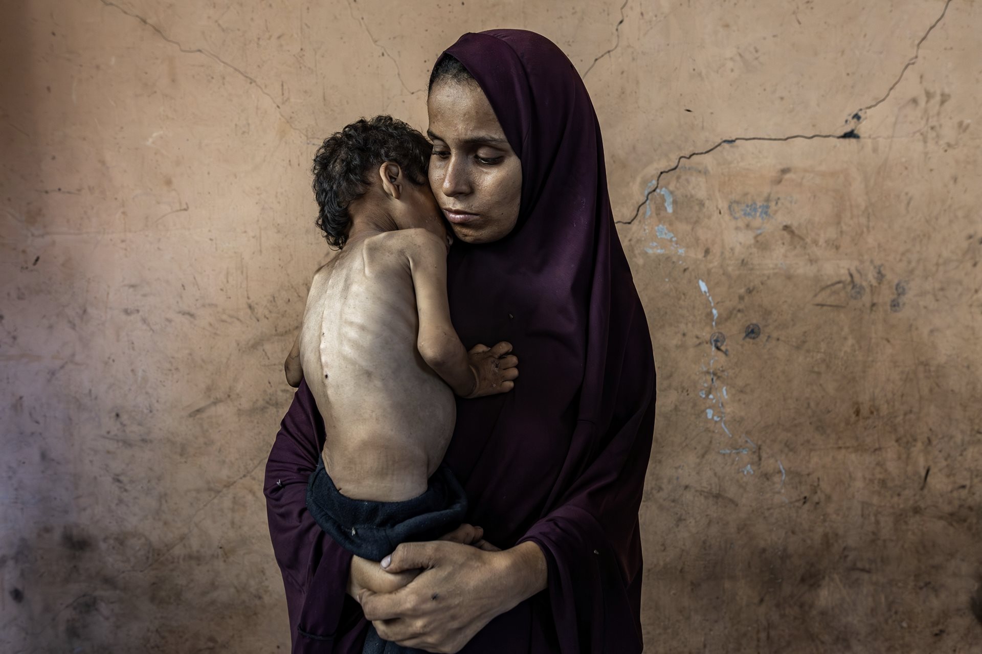 Yazan Abu al-Foul (2) with his mother, Naeema, who cannot find enough food to feed him. Nearby hospitals were short on resources, and could not provide him with inpatient care. Al-Shati Refugee Camp, Gaza City, Gaza Strip.