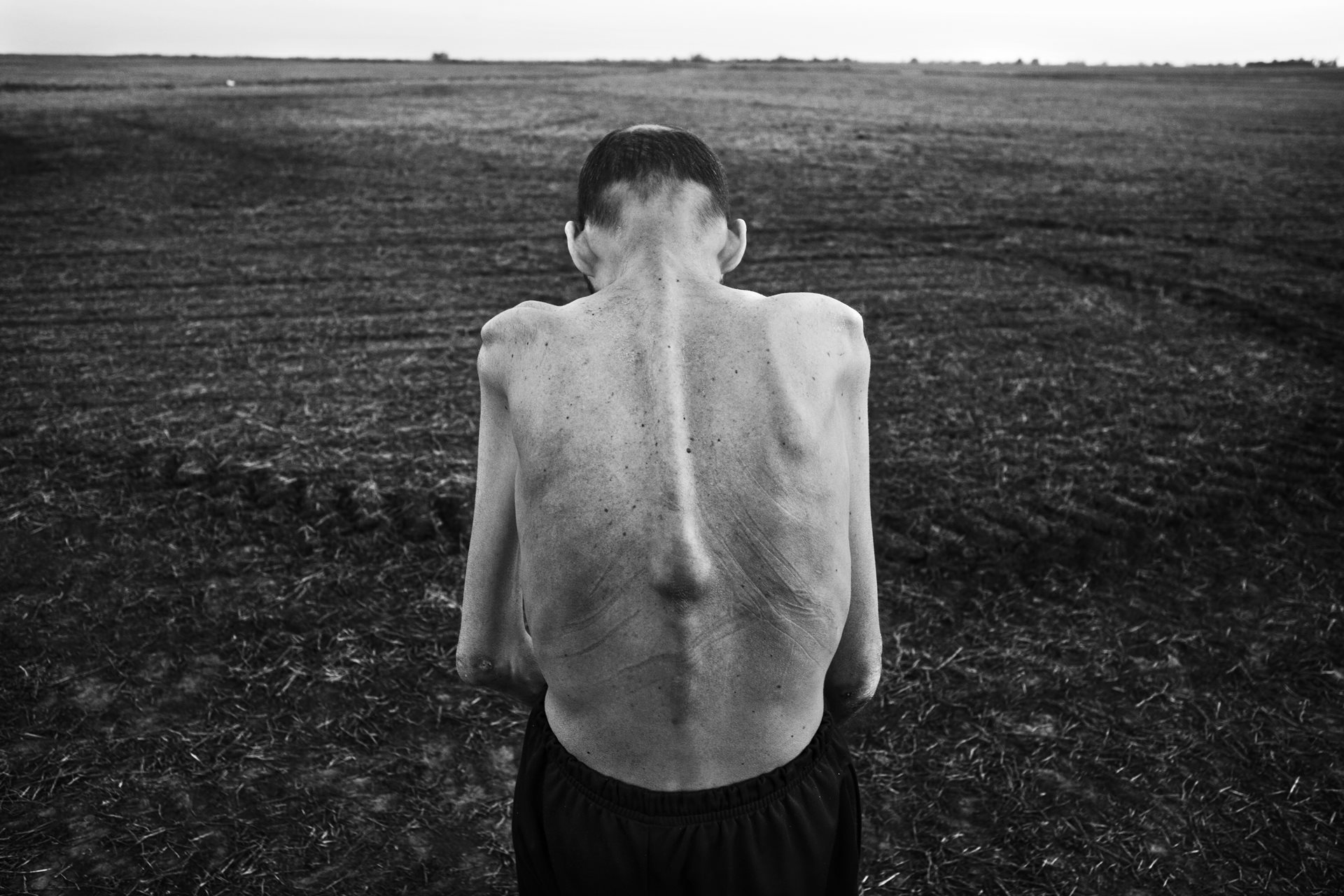 Fabián Tomasi, a former agrochemical worker, suffered from severe toxic polyneuropathy and became a global face of the fight against agrotoxins. He passed away in 2018. The photo was taken in&nbsp;Entre Ríos, Argentina.