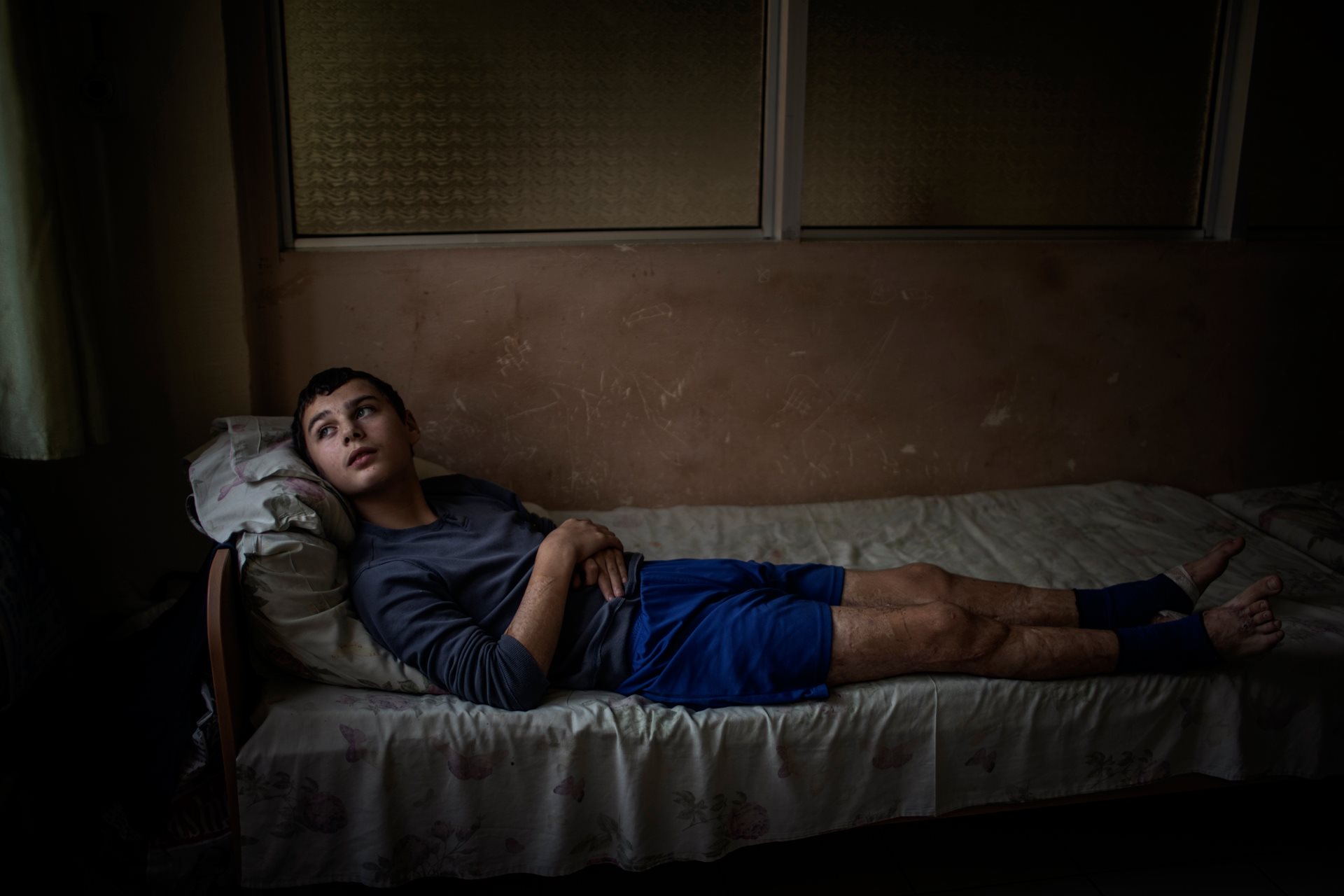 Mykhailo Baev (12) at Saint Nicholas Pediatric Hospital in Lviv, Ukraine, where he is recovering after a rocket strike on 7 July that killed his father and wounded him and his brother. &ldquo;War is evil because it takes everything from good people,&rdquo; he says.